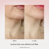 Dual Exosome Repair Shot