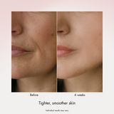 Dual Exosome Repair Shot