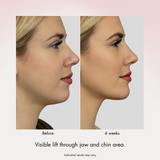 Dual Exosome Repair Shot